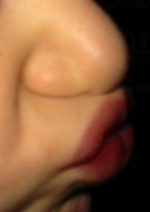 Nose closed against upper lip, side view